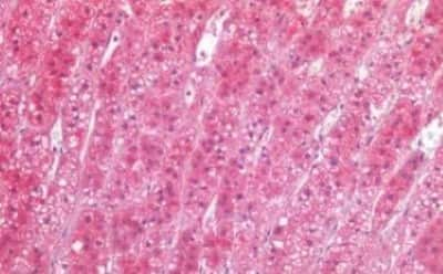 Immunohistochemistry-Paraffin: TIAM1 Antibody [NBP3-14496] - Human Adrenal: Formalin-Fixed, Paraffin-Embedded (FFPE)